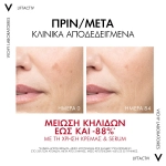 Vichy Liftactiv Pigment B3 Specialist SPF50 50ml - Image 7